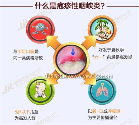 疱疹性咽峡炎五个分期图片,有1-2天的潜伏期/会高烧38度以上